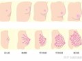 乳房产后扁平怎么办(为什么产后乳房变平了)