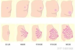 乳房产后扁平怎么办(为什么产后乳房变平了)