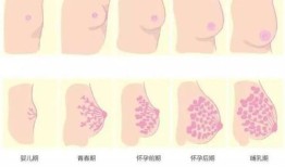 乳房产后扁平怎么办(为什么产后乳房变平了)