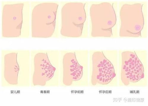 乳房产后扁平怎么办(为什么产后乳房变平了)